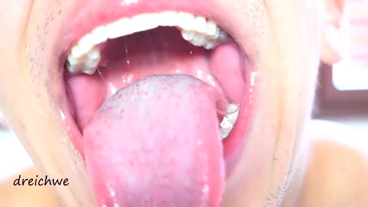 Brother Sister Delicious Wide Open Mouth With Lots Of Saliva Nigeria - 2